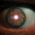 Oh, My Eye!!!
